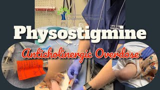 Physostigmine for Severe Doxylamine Overdose [upl. by Veronika]