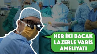 Her İki Bacak İçin Lazerle Varis Ameliyatı [upl. by Takeo]