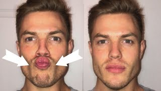 3 Exercises To Lose CHUBBY Cheeks Get a Defined Face [upl. by Kevin]