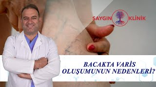 Bacakta Varis Oluşmasının Nedenleri [upl. by Gillmore]