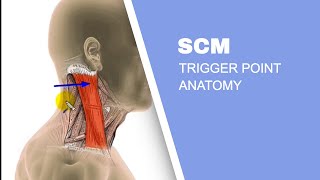 Sternocleidomastoid Muscle SCM Trigger Points [upl. by Lavelle]