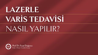 Lazerle Varis Tedavisi Nasıl Yapılır [upl. by Pelligrini]